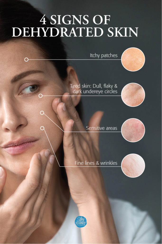 Image of a woman looking in an unseen mirror at and touching her cheek. Titled: 4 Signs of Dehydrated Skin, it includes 4 sections: Itchy patches, Tired skin: Dull, flaky & dark undereye circles, Sensitive areas and Fin lines & wrinkles. Each section has a small image of what the skin condition looks like.
